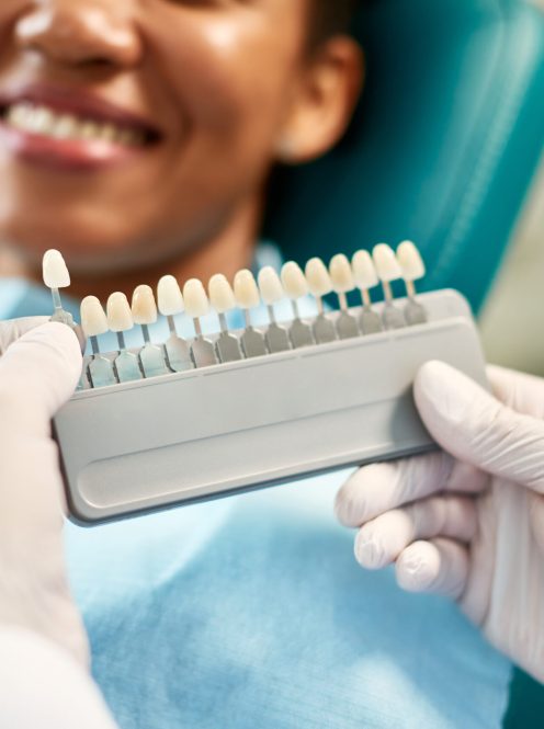 dental bridges