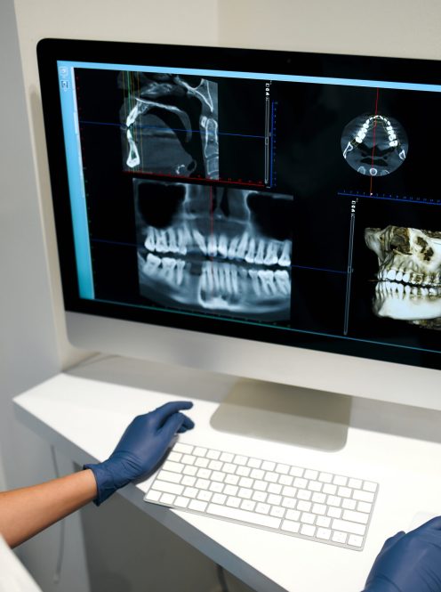 Type Of X-Ray