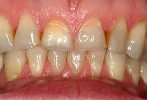 custom_images_gallery_before06 (1)